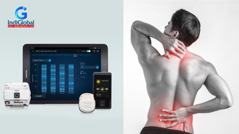 First procedure with Intellis rechargeable spinal cord stimulator for chronic pain management