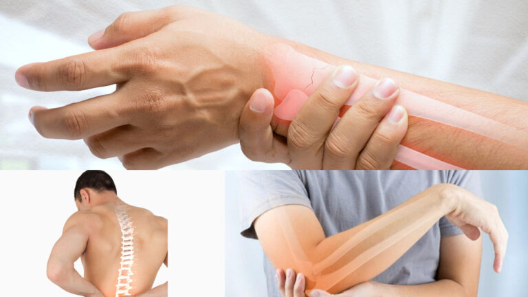 Bone Health Affects The Quality of Life