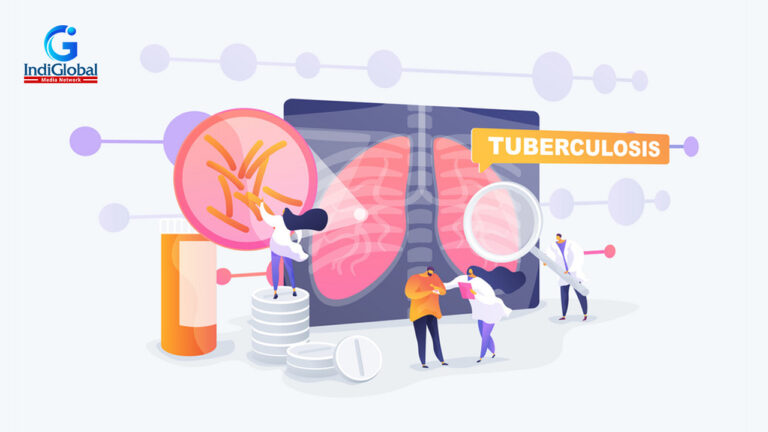 World’s Oldest Disease Tuberculosis increased during the Pandemic