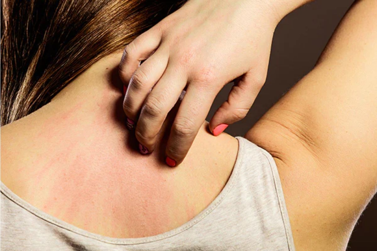 Ayurveda Scientifically Reverses Skin Diseases